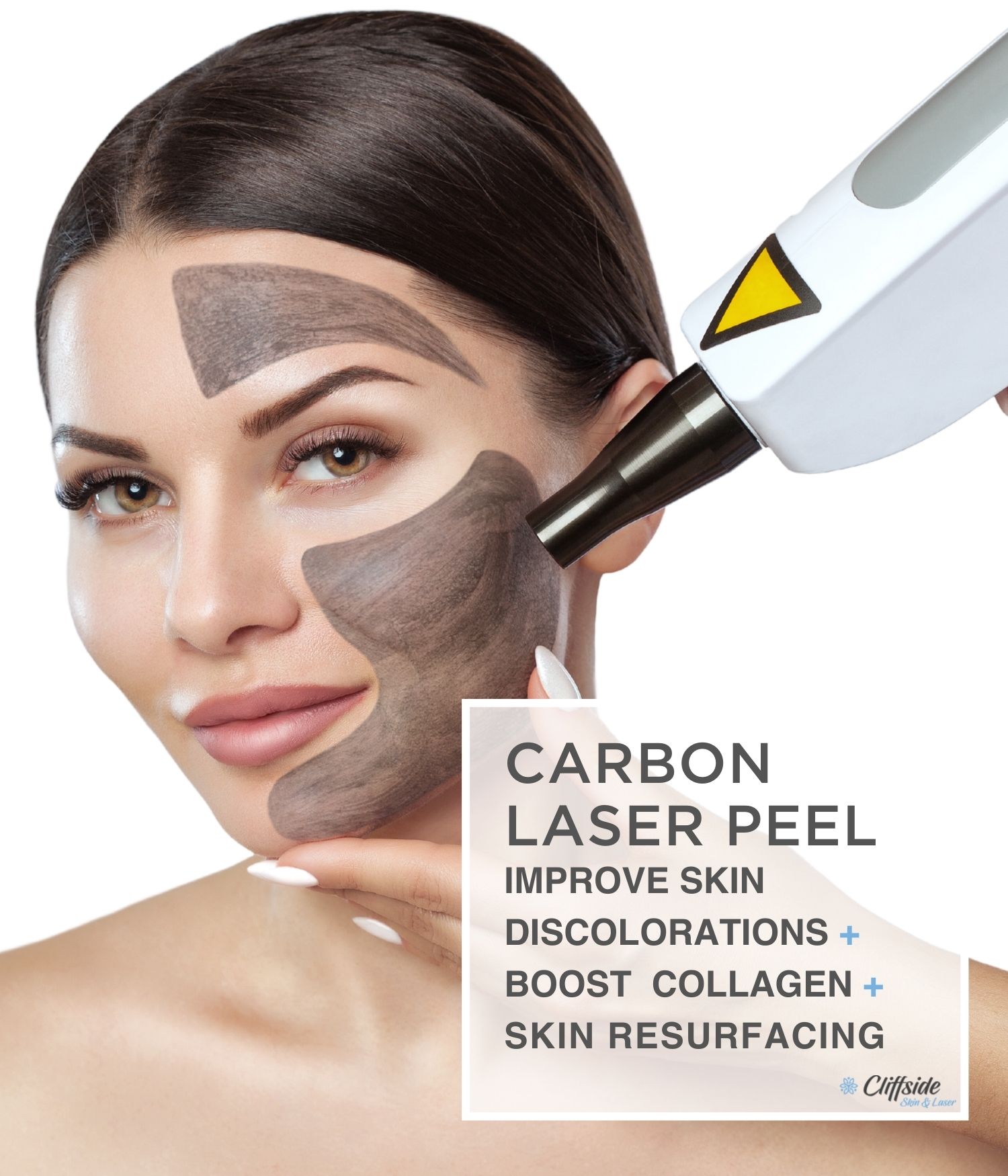 woman with beautiful face after Carbon face peel